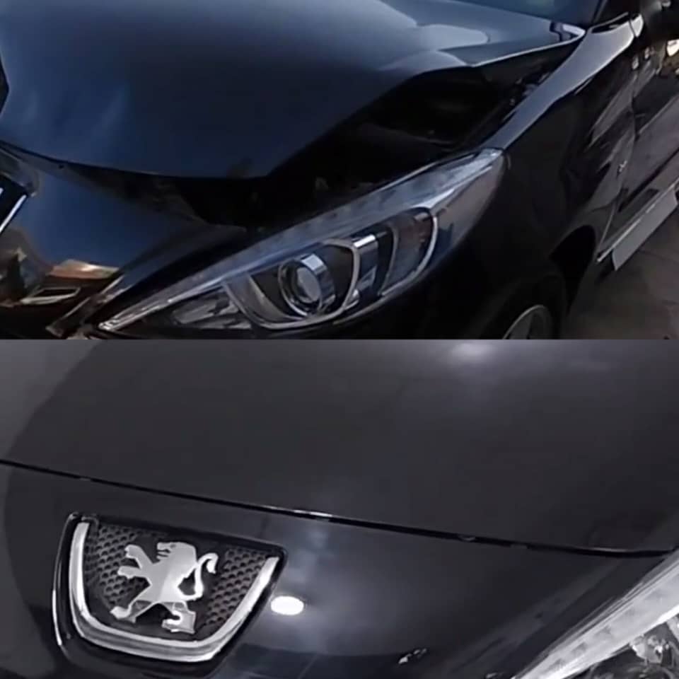 قبل و بعد صافکاری بیرنگی